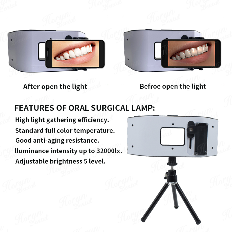Dental Flash Light Sprzęt foto – Photography Lighting Led recenzja i cena